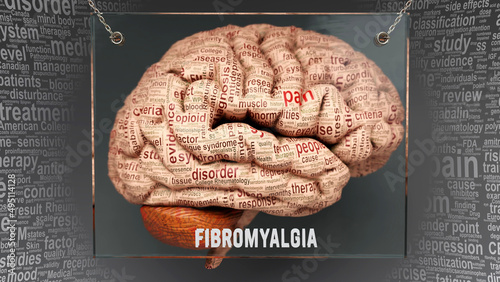 Fibromyalgia anatomy - its causes and effects projected on a human brain revealing Fibromyalgia complexity and relation to human mind. Concept art, 3d illustration photo