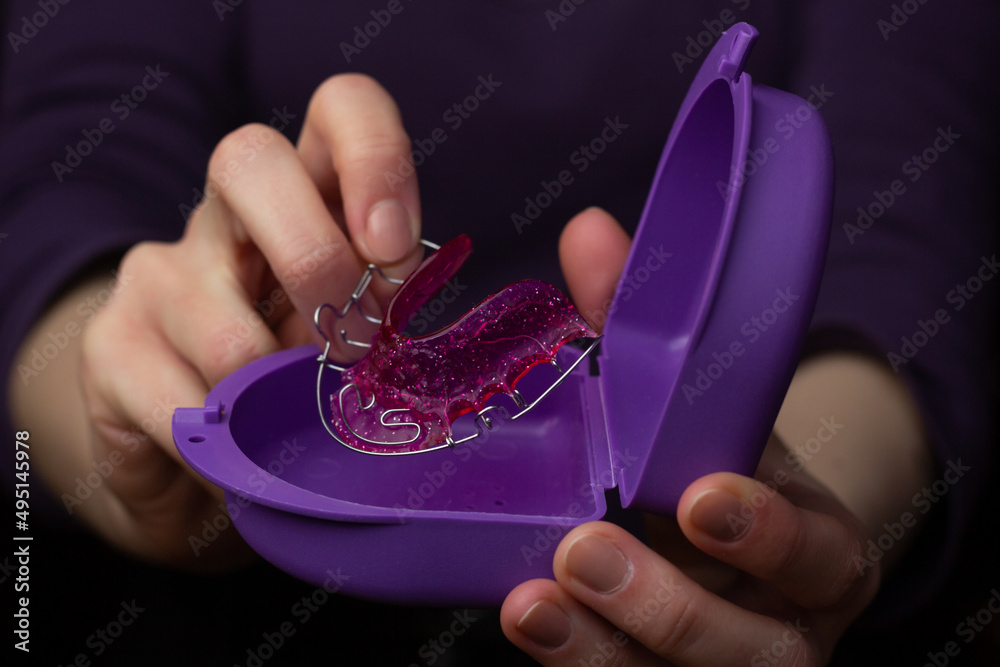 Closeup of a woman taking Hawley retainer out of a case.