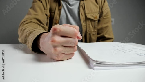 Irritated employee hits white table surface with fist doing tedious paper work. Man in mustard jacket expresses anger sitting in office closeup photo