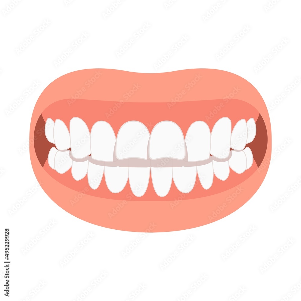 bad bite teeth mouth open deep gum Joint pain jaw surgery corrective bone oral smile Lower Weak Chin health extra Spacing Anterior fixed bad bite teeth mouth open deep gum Joint pain jaw surgery corrective bone oral smile Lower Weak Chin health extra Spacing Anterior fixed