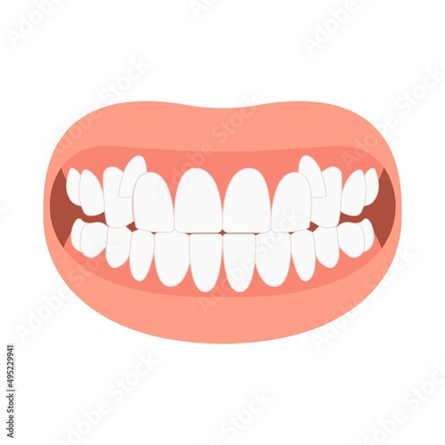 bad bite teeth mouth open deep gum Joint pain jaw surgery corrective bone oral smile Lower Weak Chin health extra Spacing Anterior fixed