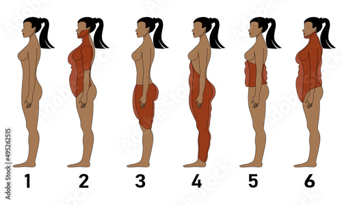 Female body types, individual structure of body fat, infographic style, flat vector illustration.