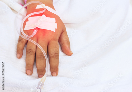 Photos Close up IV infusion in a child patients hand,Close up Children patient's hand r