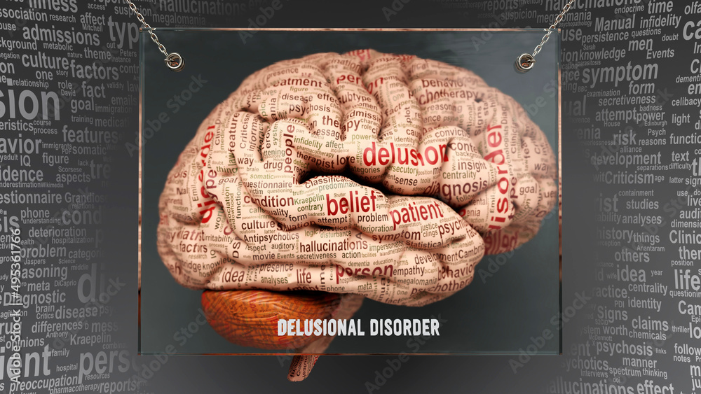 Delusional disorder anatomy - its causes and effects projected on a ...