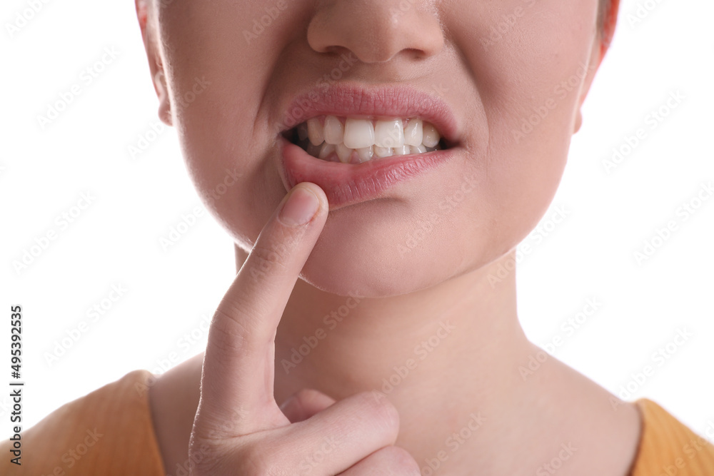 Fototapeta premium Woman showing gums on white background, closeup view