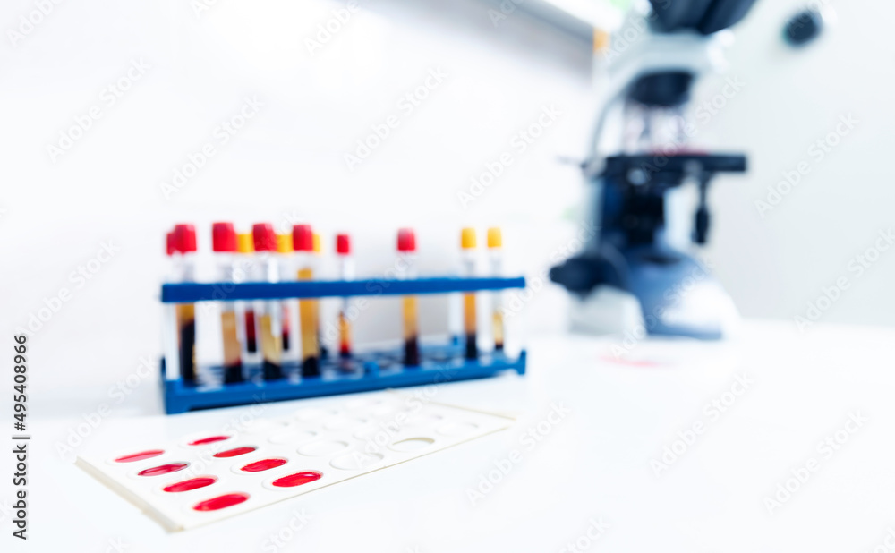 Macro photo analyzing blood in tube background microscope at laboratory , banner white light blue color toning Macro photo analyzing blood in tube background microscope at laboratory , banner white light blue color toning