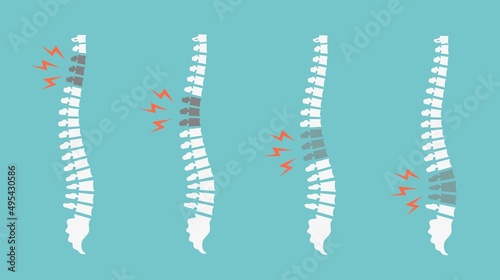 Backache spines set. Back pain vector icon illustration isolated. Damaged Disks