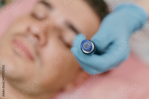 Microneedles for collagen induction therapy. apparatus with needles close-up photo