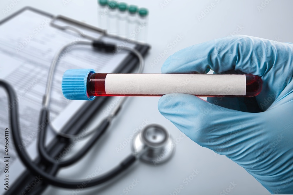 Blood tube for test detection of virus Covid-19 Omicron Variant on papers document. Blood tube for test detection of virus Covid-19 Omicron Variant on papers document.