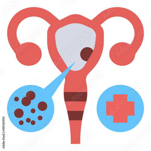 cervical cancer