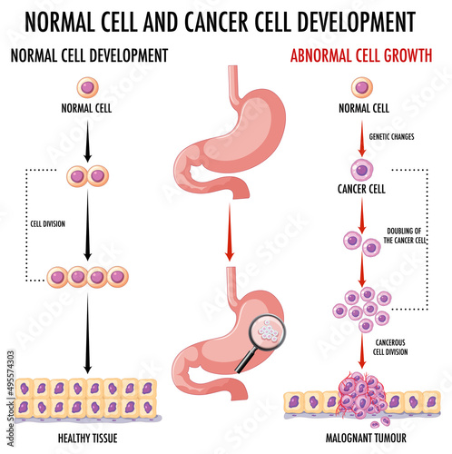 Diagram showing normal and cancer cells in human