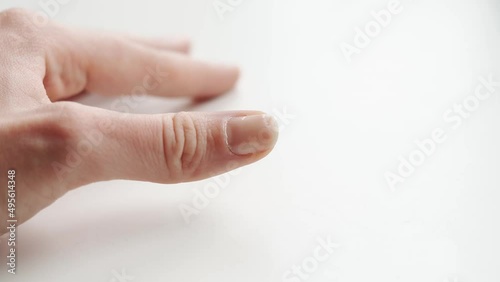 Close up of brittle nails on woman hand. White background. Brocken and dry fingernail. Avitaminosis and micro elements deficits 