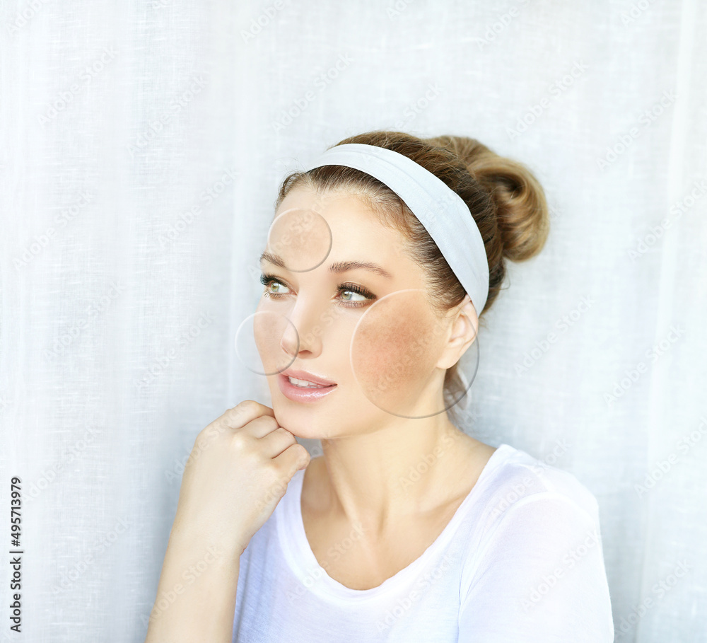 Dark spots, freckles,hyperpigmentation(melasma or chloasma),concept - skin lightening, skin whitening, fruit acids,AHA, Skin Brightening. Dark spots, freckles,hyperpigmentation(melasma or chloasma),concept - skin lightening, skin whitening, fruit acids,AHA, Skin Brightening.