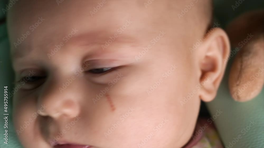 Close-up of a baby's face. The frowning child looks into the camera with large, wide eyes. Scratch on the cheek. Light eyebrows, black eyelashes, nose. Glare in the eyes. Day. Flat. Static camera Close-up of a baby's face. The frowning child looks into the camera with large, wide eyes. Scratch on the cheek. Light eyebrows, black eyelashes, nose. Glare in the eyes. Day. Flat. Static camera