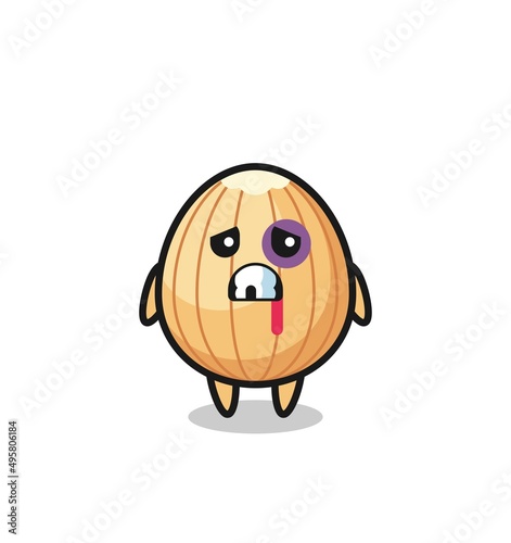 injured almond character with a bruised face