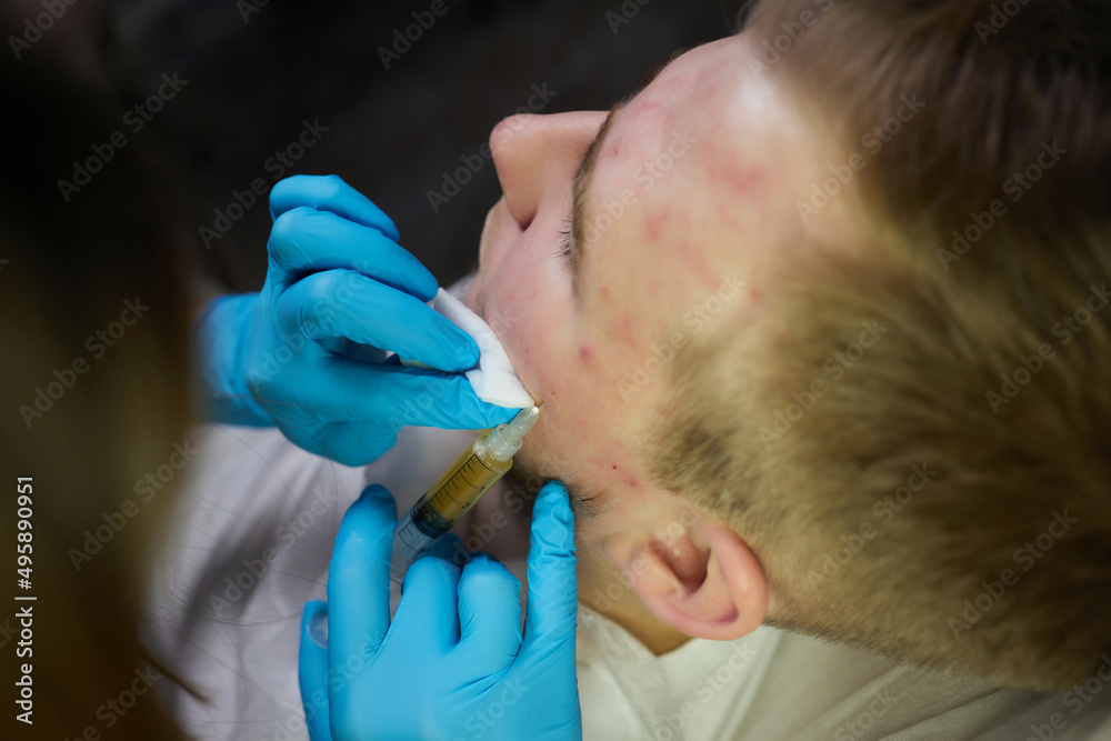 Injection at spa salon. Doctor hands in gloves. Closeup. Pretty male ...