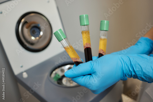 Beautician doctor's hands put test tube with blood in centrifuge container. Rejuvenation plasmolifting procedure.