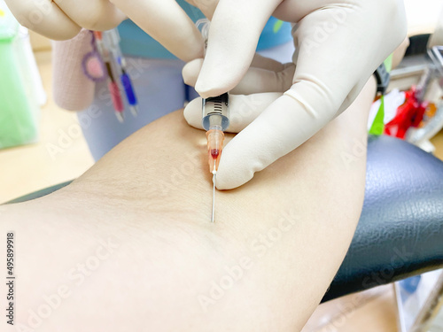 Female doctor in medical gloves hand holding syringe and making an injection into a vein on upper arm. antipyretic injection, steroids, disinfectant`, pain relief, inflammation