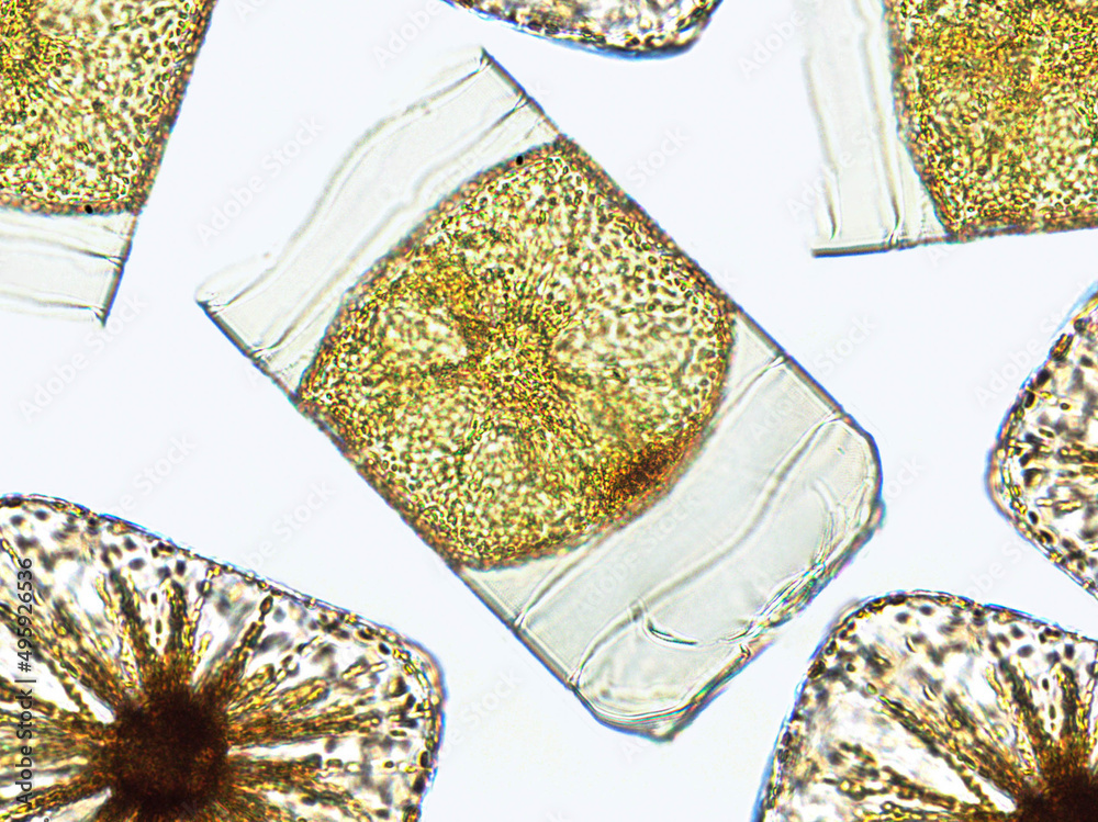 Algae under microscopic view, Chrysophyte, diatoms, phytoplankton ...