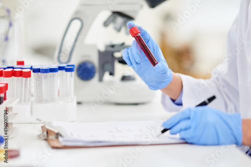 Observing facts and recording findings. Closeup shot of a scientist examining a blood sample and recording findings in a lab.