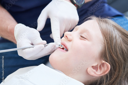 Braces for child teeth correction. Installation and maintenace