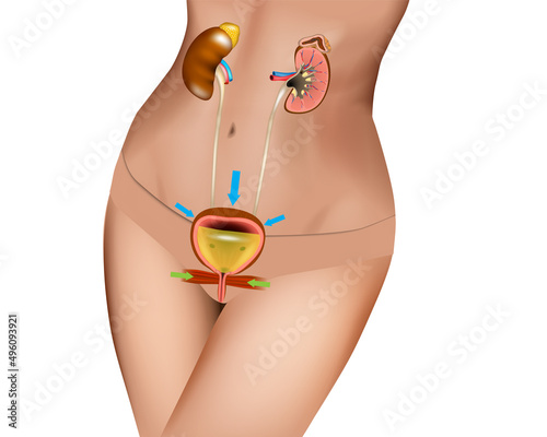 The Human urinary system, also known as the renal system or urinary tract. Kidney, Renal pelvis, Ureter, Urinary bladder, Adrenal gland. Urinary incontinence. Vector