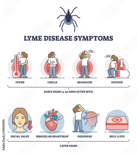 Lyme disease symptoms with early and later illness signs outline diagram. Labeled educational scheme with tick bite problems vector illustration. Medical parasite sickness with bulls eye and fatigue.