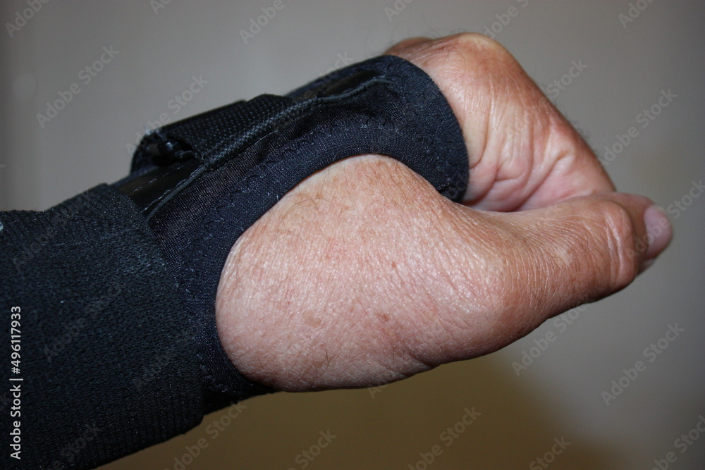 Obraz premium Nahaufnahme einer linken Hand mit Handgelenkorthese