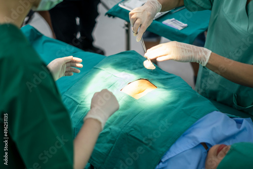 Professional Medical Surgeons team performing surgical operation. Surgical operation. Surgeons at work in operating theater toned in green. Nurse preparing medical tools for operation.