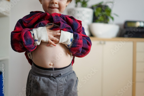 the child shows the belly. Pain in the abdomen in children. Umbilical hernia

