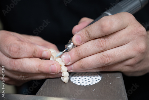 ponçage d'implant dentaire