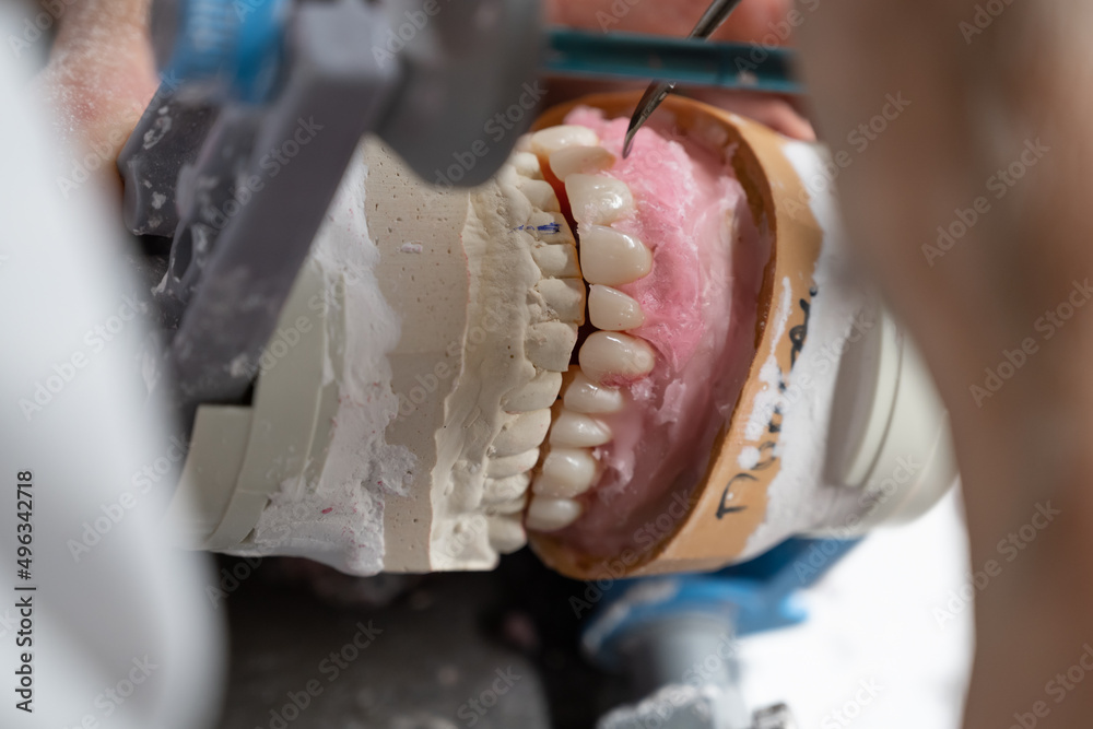 création dentier