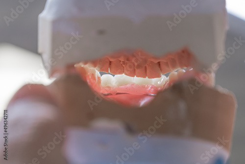 création dentier photo