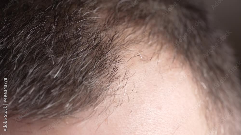 The beauty of a man. Macro hair of the scalp. A man's head in close-up. Alopecia, age-related changes, gray hair and hair loss.