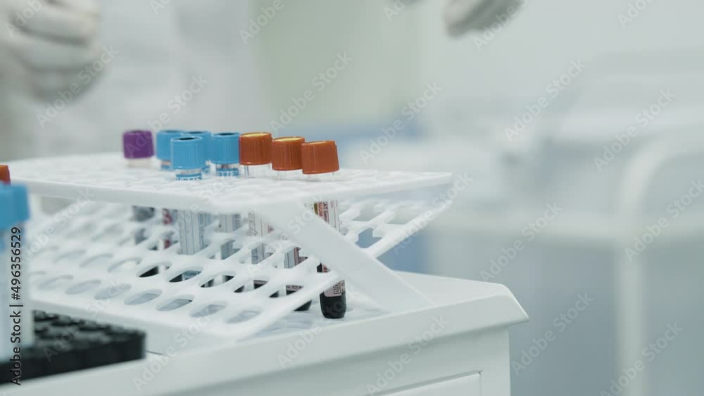 Close-up of the Hand in Glove Puts Tube With Blood Samples on The Table. Material for Laboratory Testing or Experiments. Concept: Research, Biochemistry, Pharmaceutical Medicine