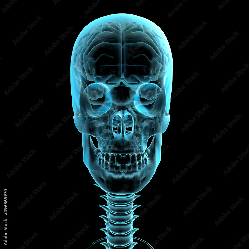 X-ray image of a human skull X-ray image of a human skull