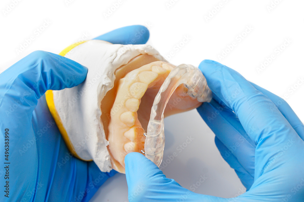 Dentist adjusting a dental splint Stock Photo | Adobe Stock