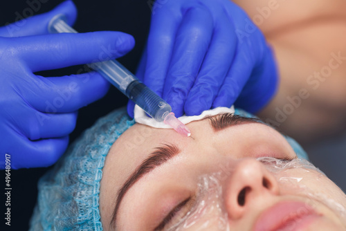 Fotografie woman during facial mesotherapy to smooth mimic wrinkles