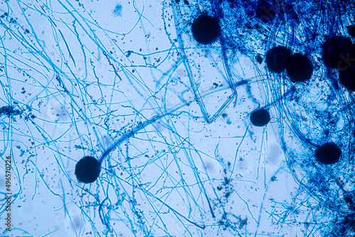 Aspergillus niger and Aspergillus oryzae (mold) under microscope for Microbiology in Lab. 