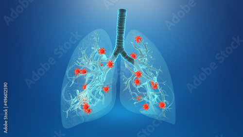 Foto Coronavirus infecting human lungs background