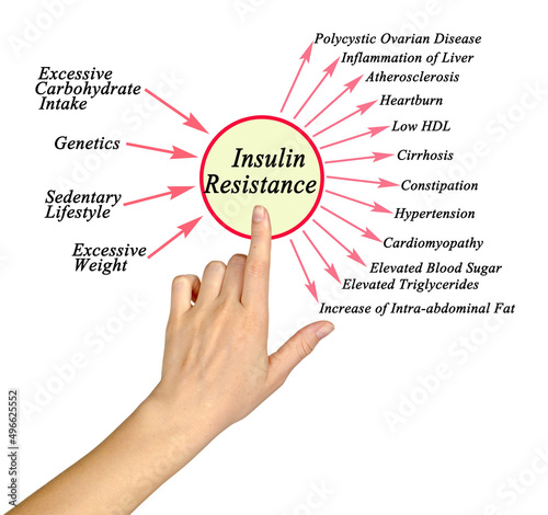 Causes and consequences of Insulin Resistance photo