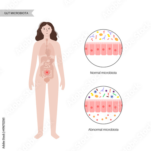 Human gut microbiota