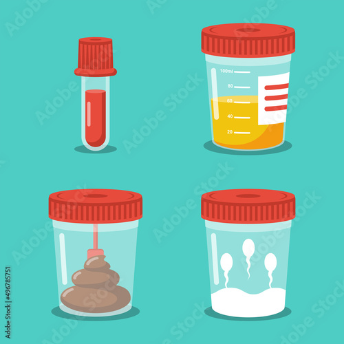 Set test tubes. Blood, urine, sperm and stool. Medical equipment. Specimen analysis. Plastic containers with biomaterial. Laboratory analysis. Vector flat design. Isolated on white background. photo