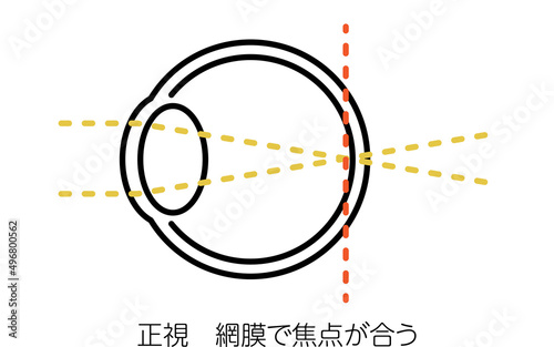 視力と屈折異常のメディカルイラスト、正視（網膜で焦点が合う）