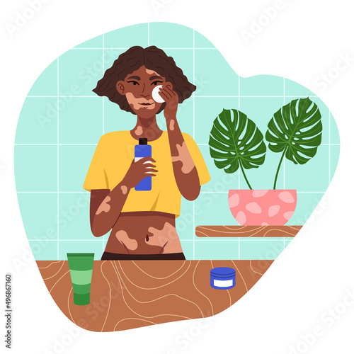 Girl with skin problems Vitiligo applies natural cosmetics for daily skin care. Morning everyday routine. Modern vector flat illustration isolated on a white background.
