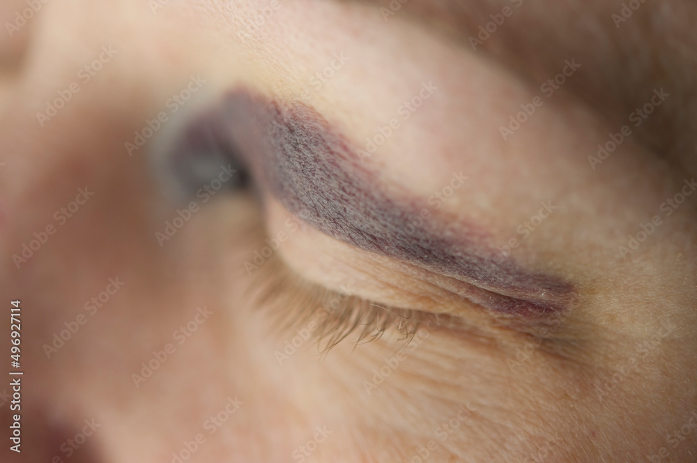 Sad beaten up girl with wounds on the face looking at the camera with deep look Sad beaten up girl with wounds on the face looking at the camera with deep look