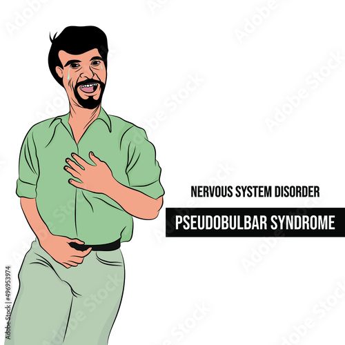 Pseudobulbar condition, involuntary and uncontrolled reaction of laughing or crying that is out of proportion to a situation.