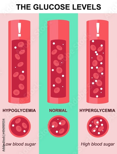 Glucose level test in blood vector lab analysis
