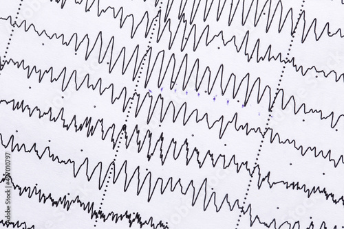 Cardiogram on a sheet of paper close-up. Texture of pulsed waves.
