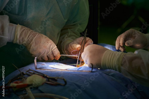 performing a surgical operation close-up. work of surgeons in the operating room. the hands of the surgeon and assistants perform the operation with surgical instruments
